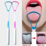 Tongue Cleaner